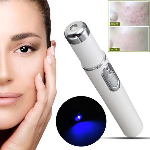 Blue Light Acne Laser Pen